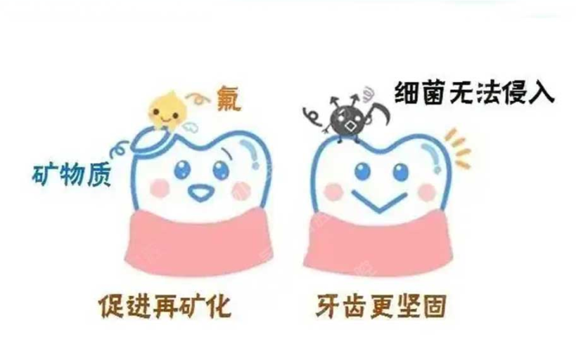 02 孩子3歲多可以開始涂氟嗎？.png