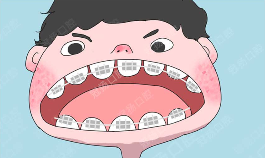 02 孩子錯(cuò)頜畸形為啥要早干預(yù)？.png