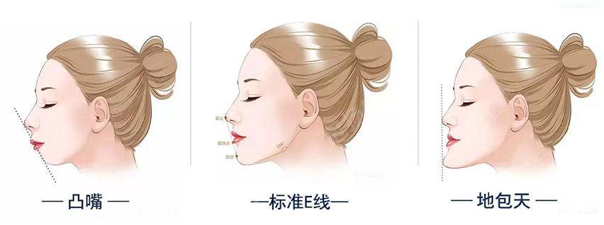 04 牙齒是如何影響頜面美觀度的.png